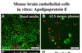 研究人员推进了为ALS患者开发基于蛋白质的治疗疗法的努力