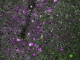 一些神经元针对微小的脑血管扩张